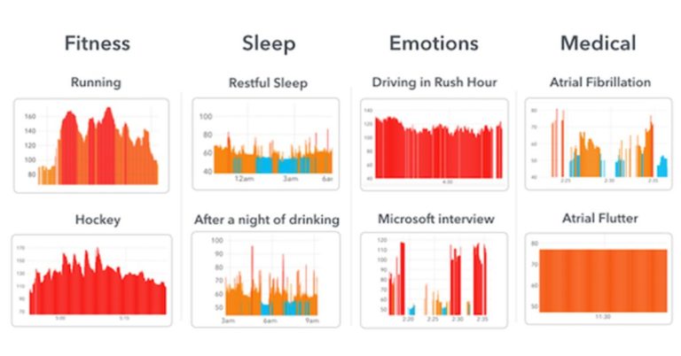 Fitbit cardiogram